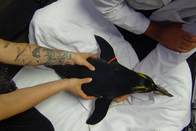 Acupuncture session